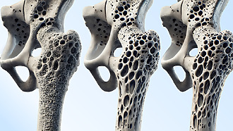 Universal access to Fracture Liaison Services could prevent 48,568 fractures and free up 338,579 acute hospital bed days over five years, saving the NHS £600m by 2031.