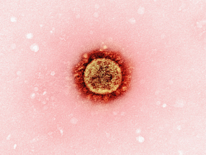 Novel Coronavirus SARS-CoV-2 Transmission electron micrograph of a SARS-CoV-2 virus particle (UK B.1.1.7 variant), isolated from a patient sample and cultivated in cell culture. Image captured at the NIAID Integrated Research Facility (IRF) in Fort Detrick, Maryland. Credit: NIAID https://www.flickr.com/photos/niaid/50997709387/