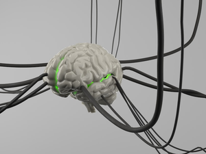Brain wire