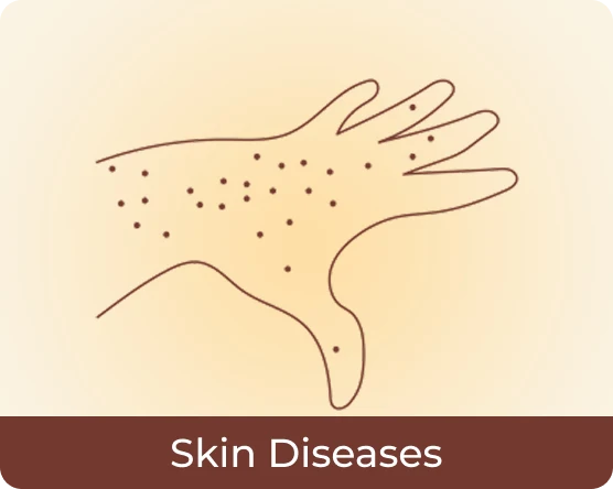 Skin Diseases
