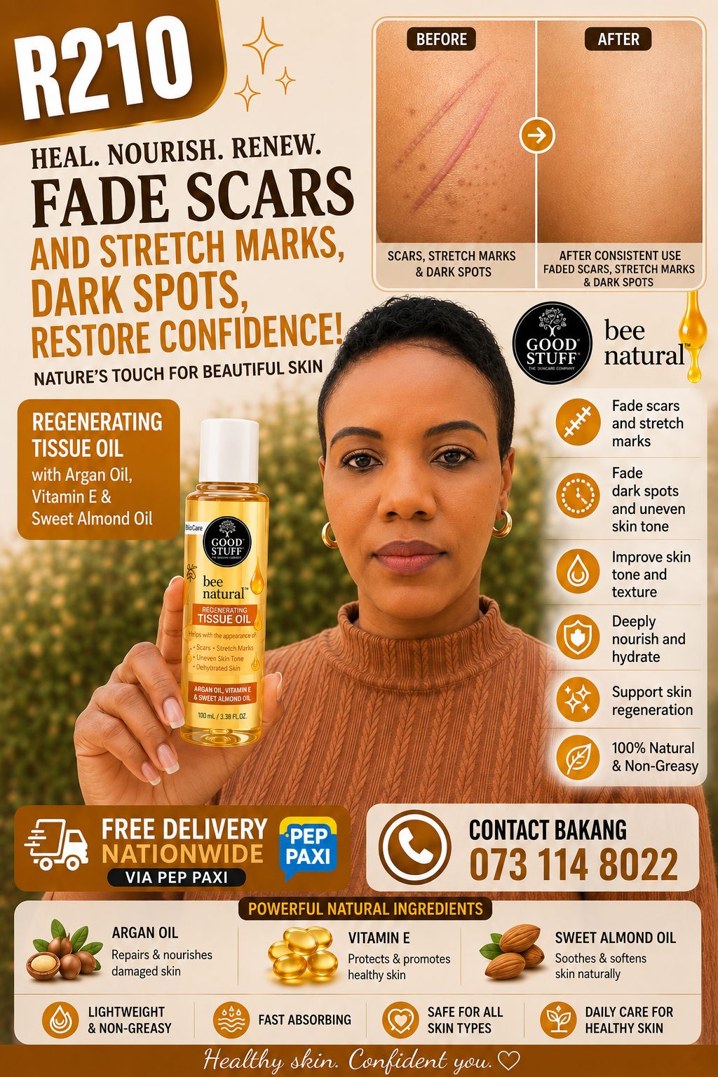 Tissue Oil for scars, stretch marks, dark spots
