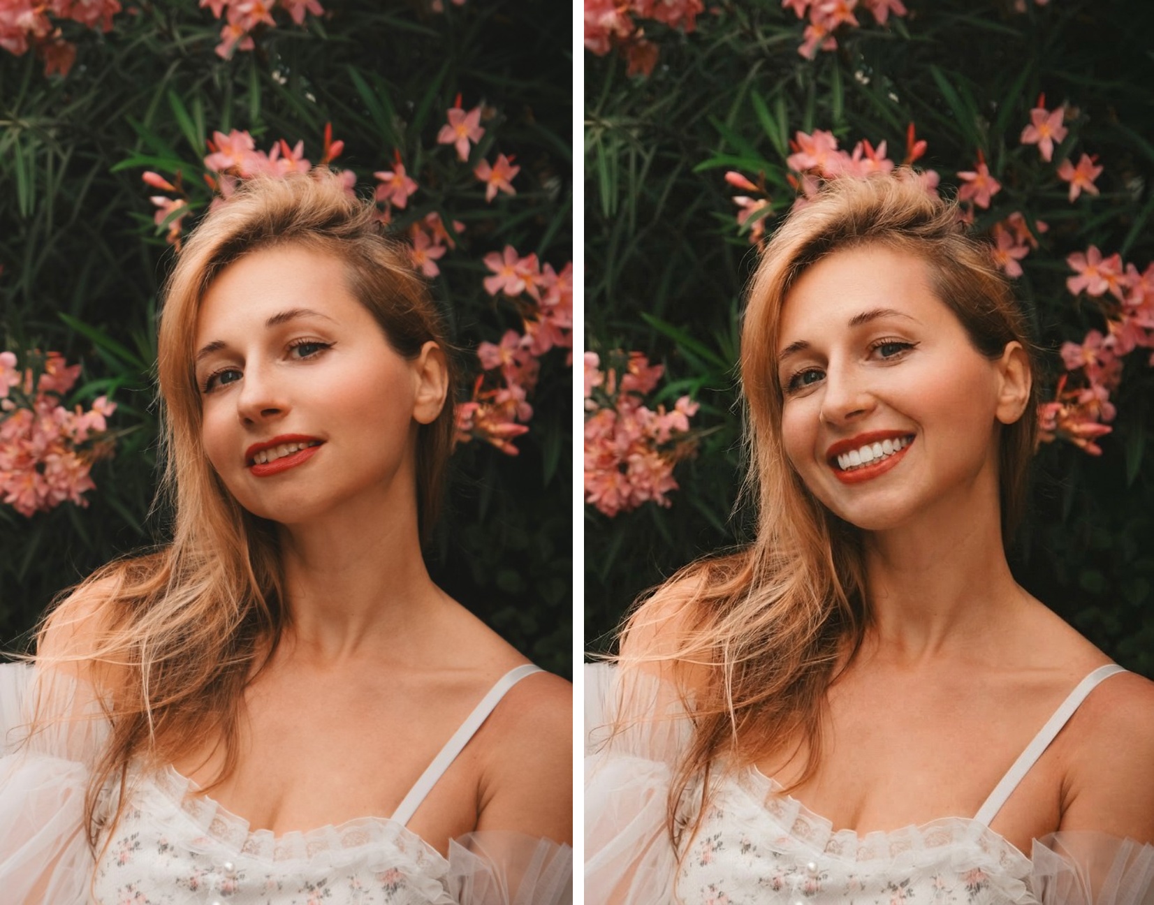 See Yourself With Veneers Before You Commit — Reaction Videos Wanted Creator
