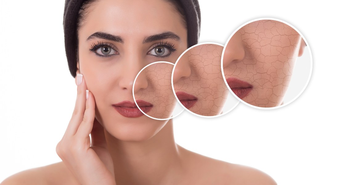 The Ultimate Guide to Caring for Dry Skin: Tips, Tricks, and Skincare Essentials_1
