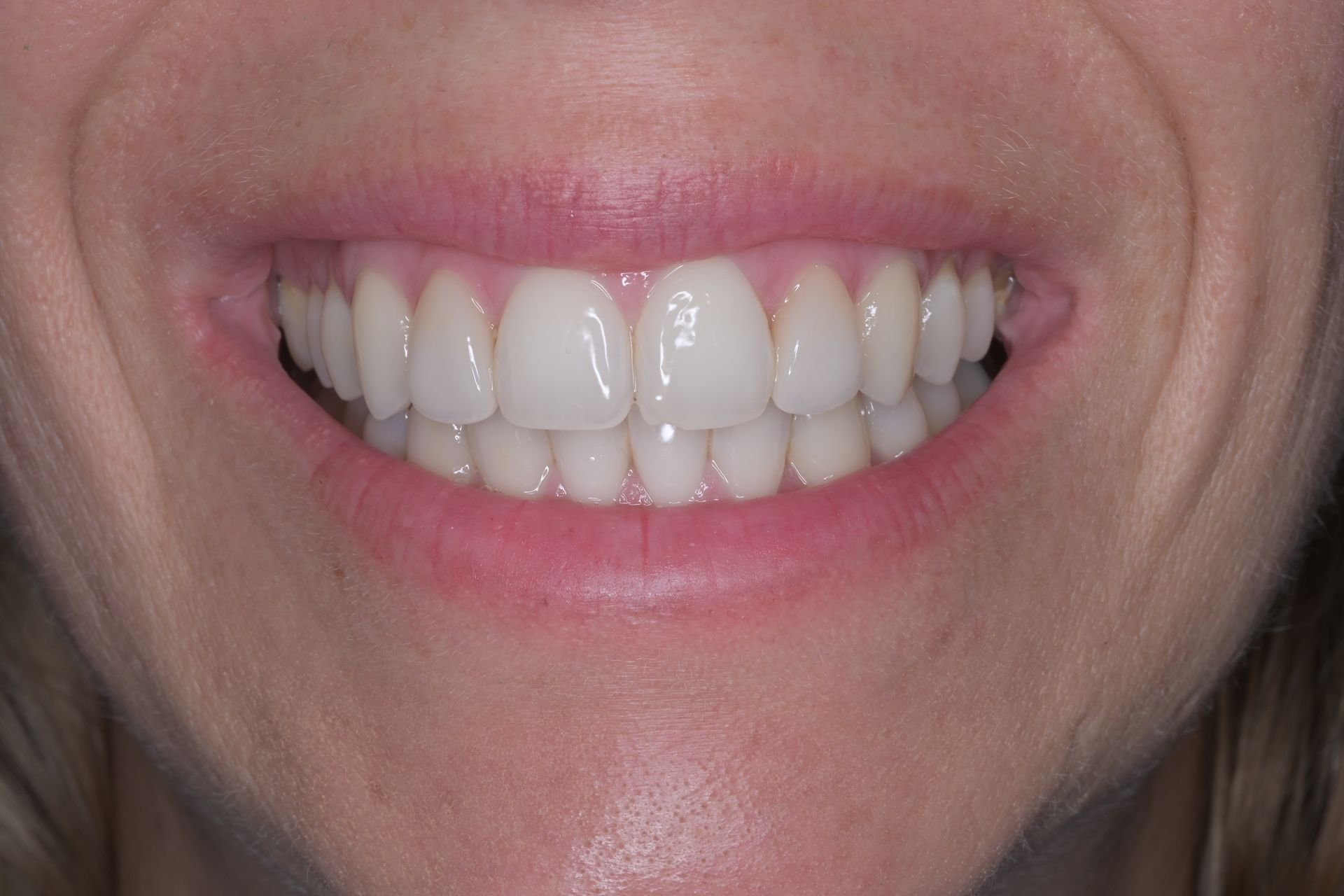 Sárina Premena – po