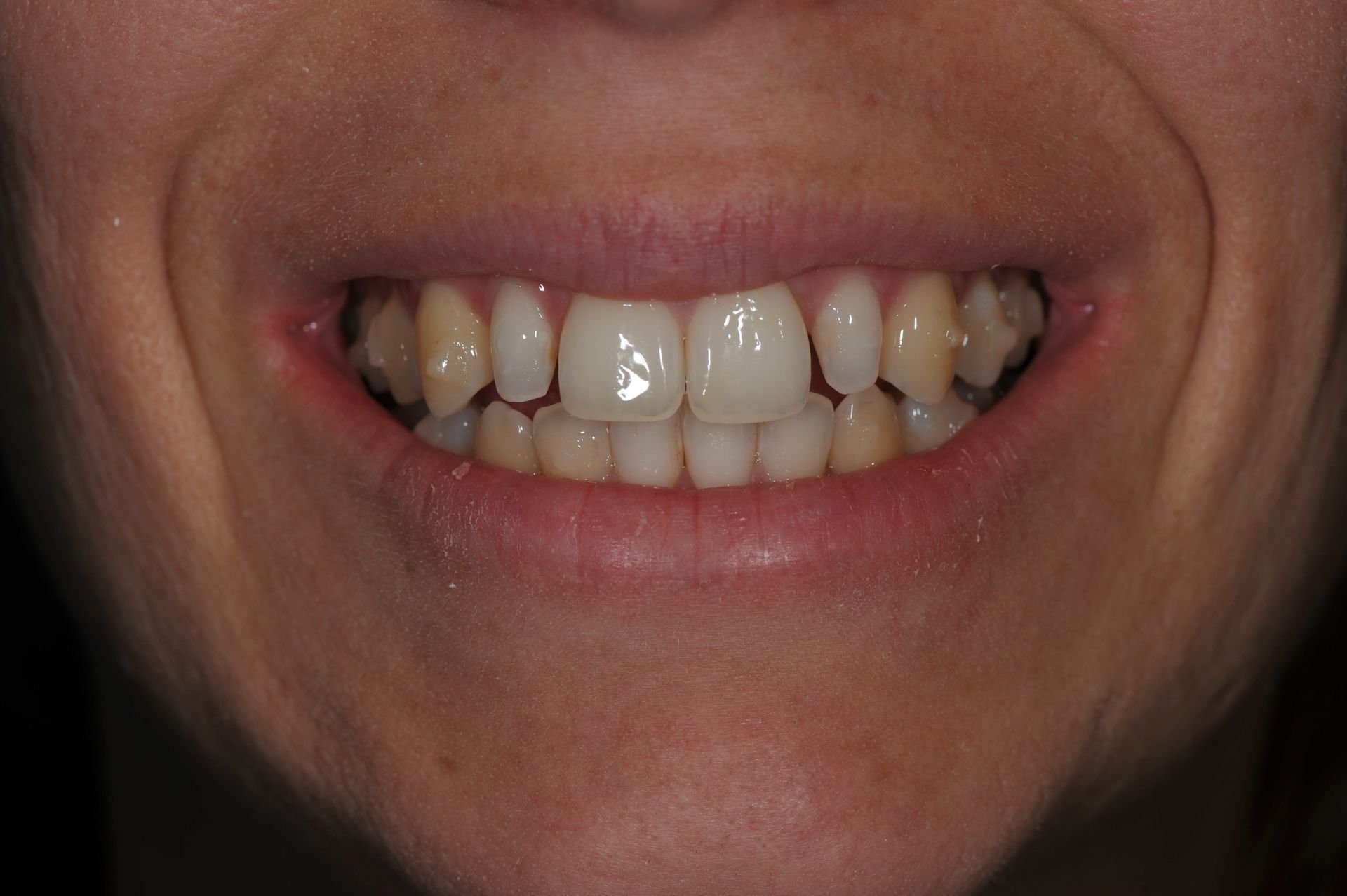 Sárina Premena – pred