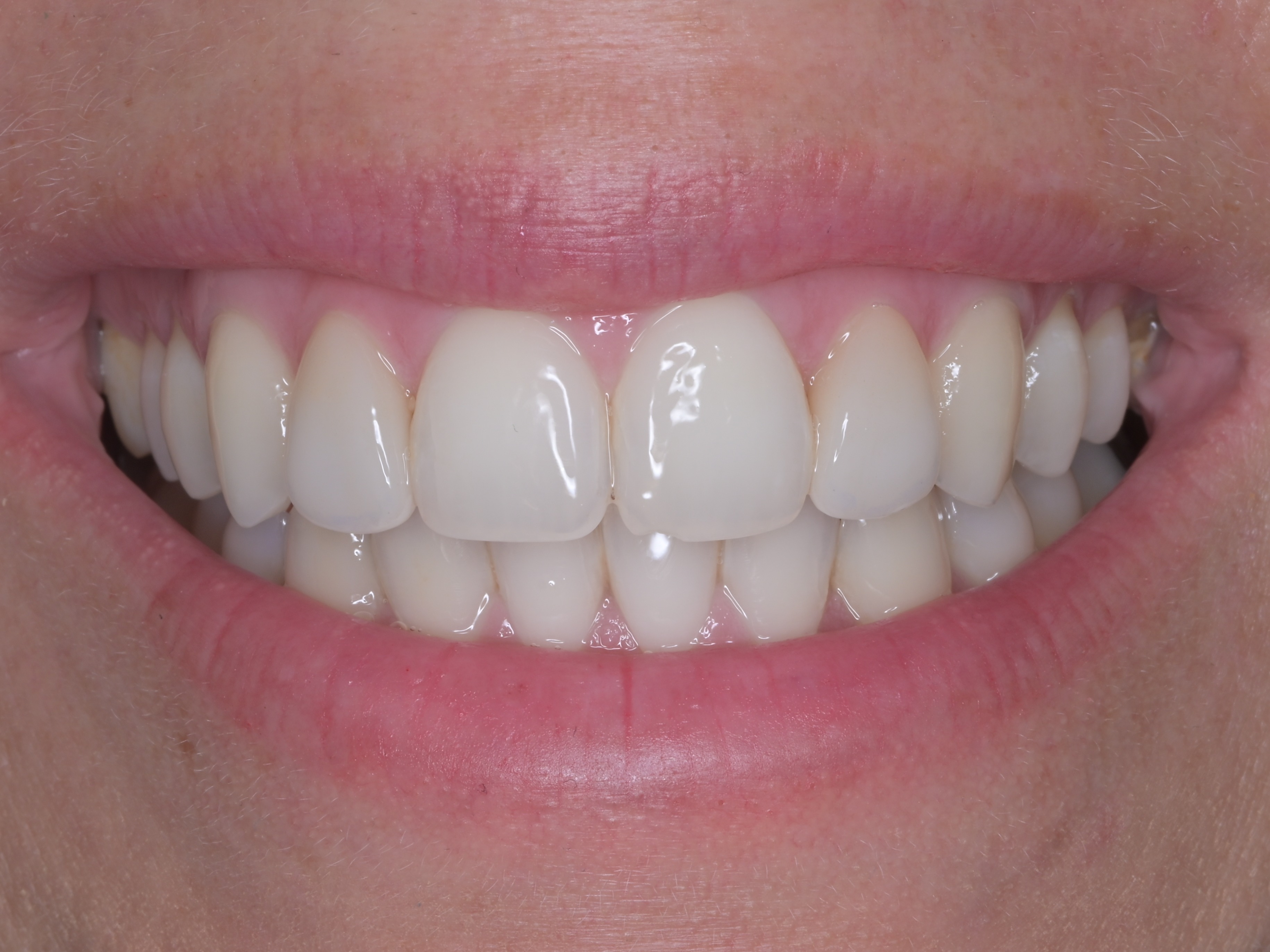 Sárina Premena – po