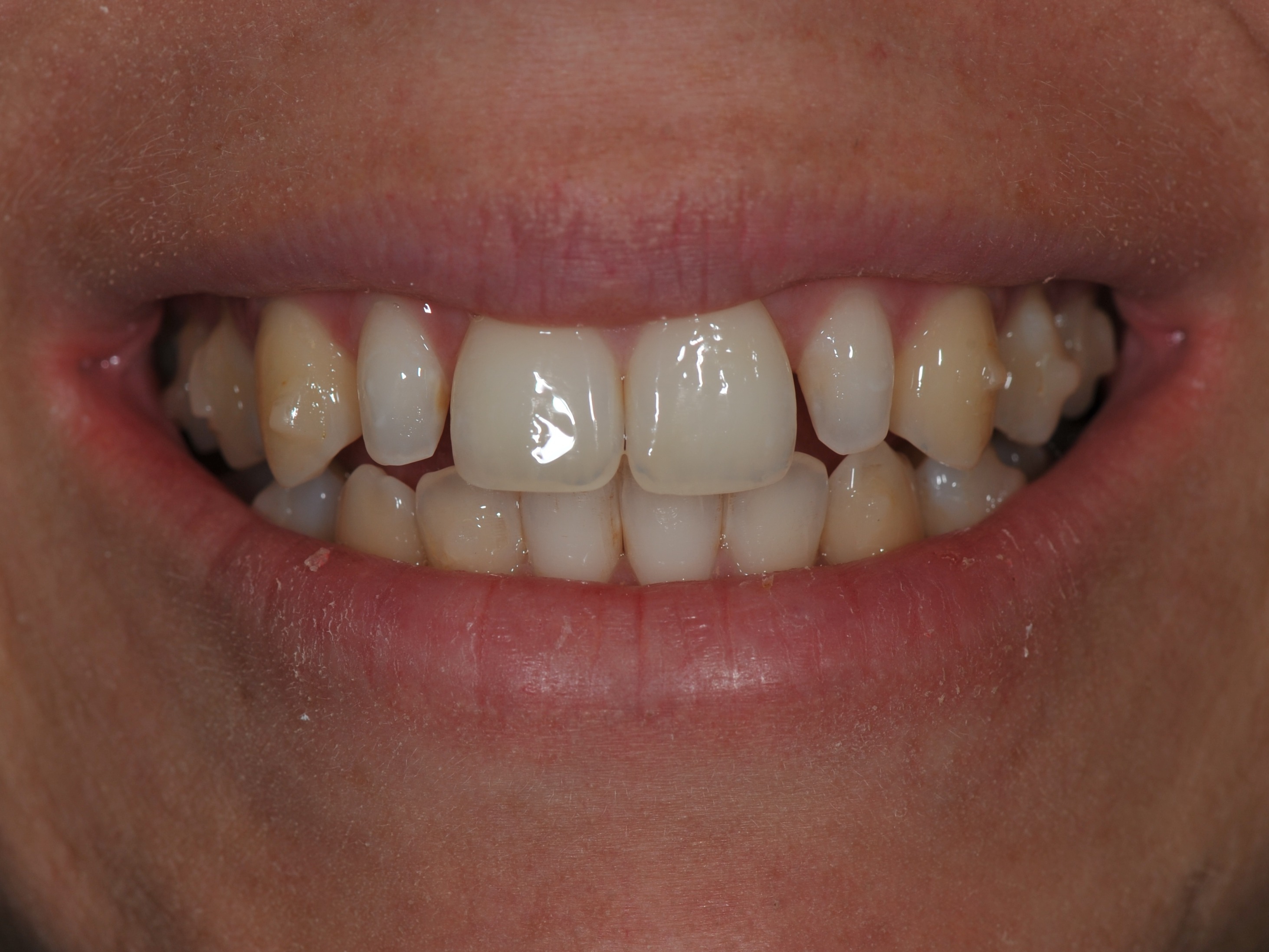 Sárina Premena – pred