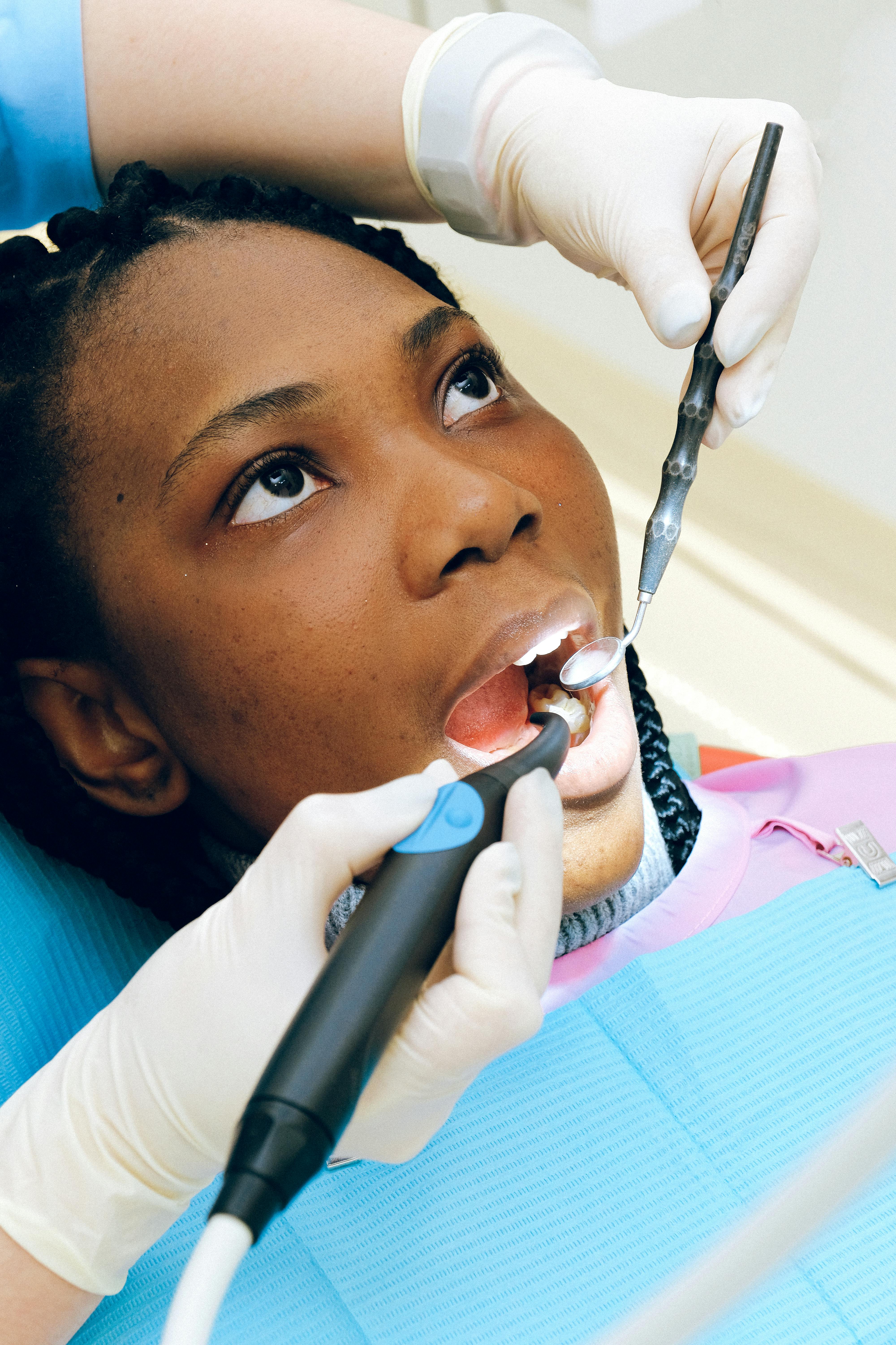 Blanqueamiento Dental