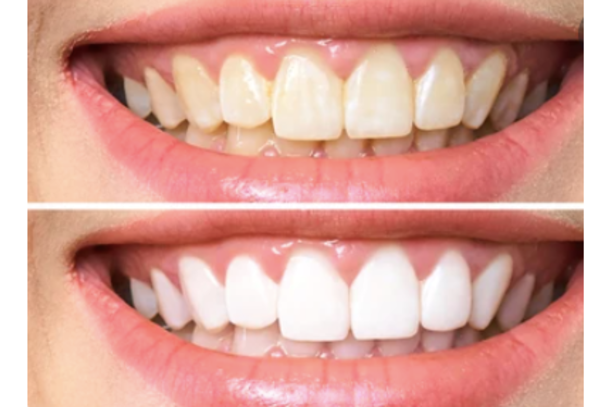 Cosmetic Dentistry