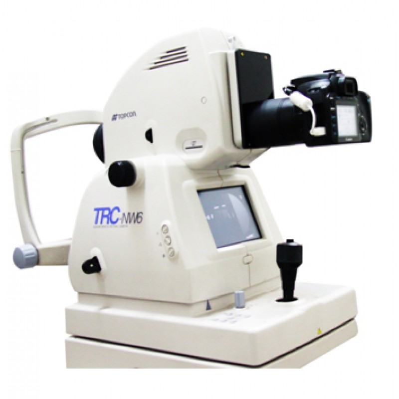Topcon TRC-NW6 Digital Upgrade Kit