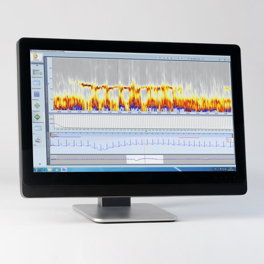 ANALYSIS OF 24-HOUR HOLTER RECORDINGS  MEDILOG DARWIN2