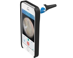 Bionix Clinician's iPhone Otoscope (Oto For Clinicans)