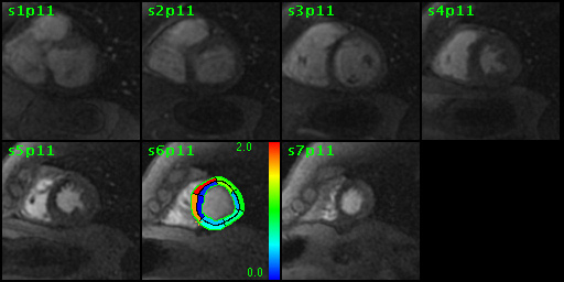CardiacVX