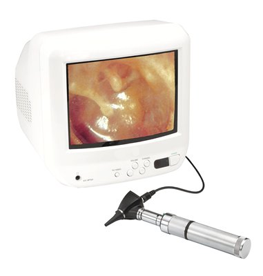 COMPACVIDEO OTOSCOPE