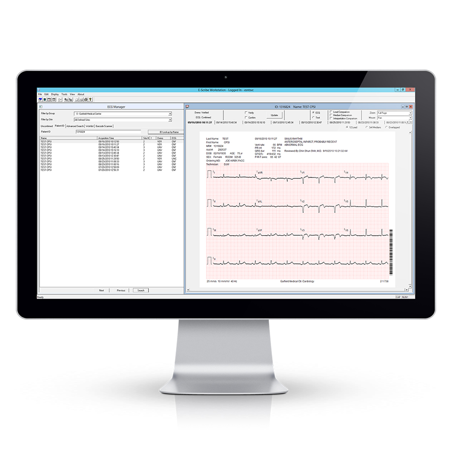 E-SCRIBE™ HOLTER ANALYSIS SYSTEM