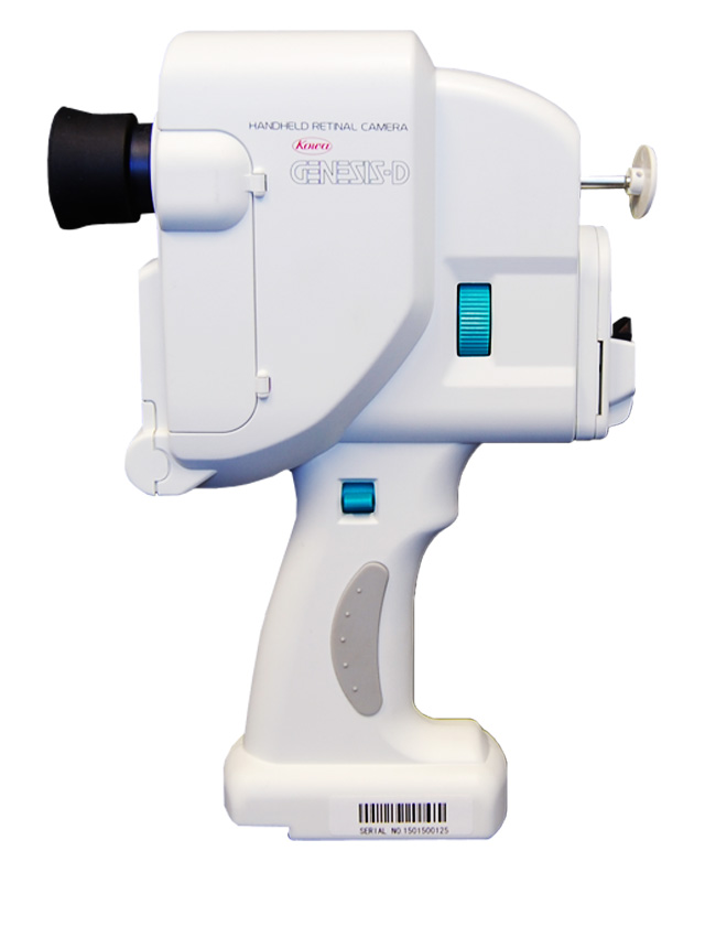 Genesis-D Portable Retinal Camera