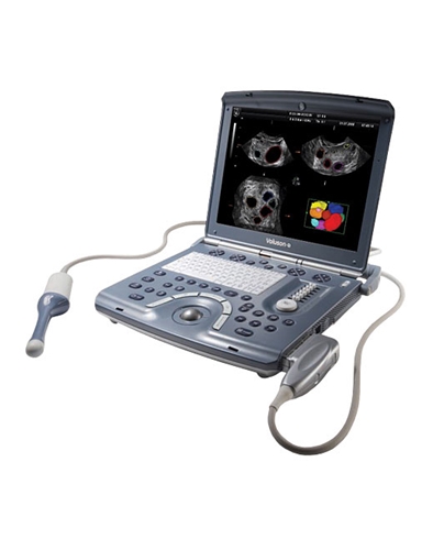 GE Voluson i Ultrasound Machine