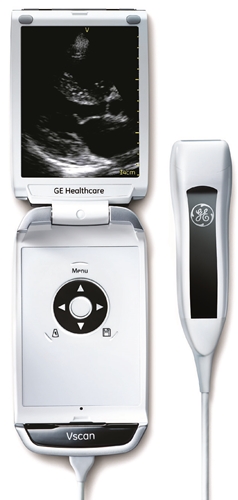 GE Vscan Portable Ultrasound