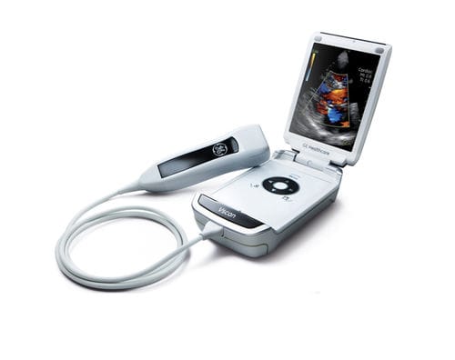 HAND-HELD ULTRASOUND SYSTEM / FOR MULTIPURPOSE ULTRASOUND IMAGING / B/W / COLOR DOPPLER VSCAN