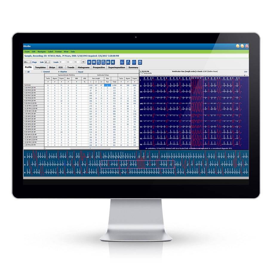 HSCRIBE™ HOLTER ANALYSIS SYSTEM
