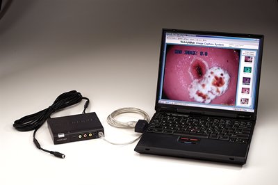 IMAGE CAPTURE SYSTEM