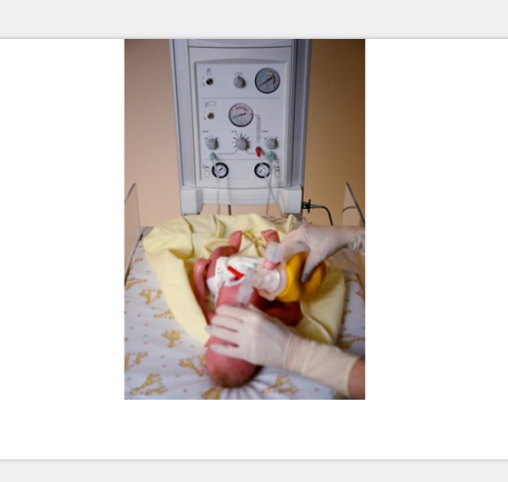 Infant Resuscitation Systems