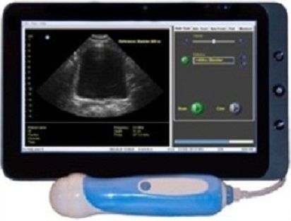 Interson ViewBladder 10 Tablet Bladder Scanner Imaging System