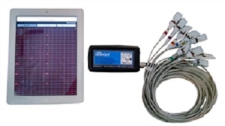 Ipad & Iphone EKG CardioCard Mobile ECG machine (iPad & iPhone Version) w/10 Lead Patient Cable, Wireless