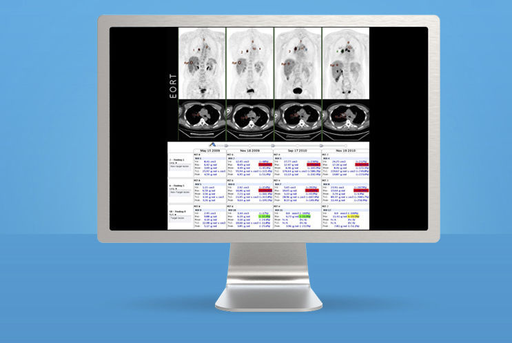MONITORING WEB APPLICATION / ONCOLOGY / CT / PET 