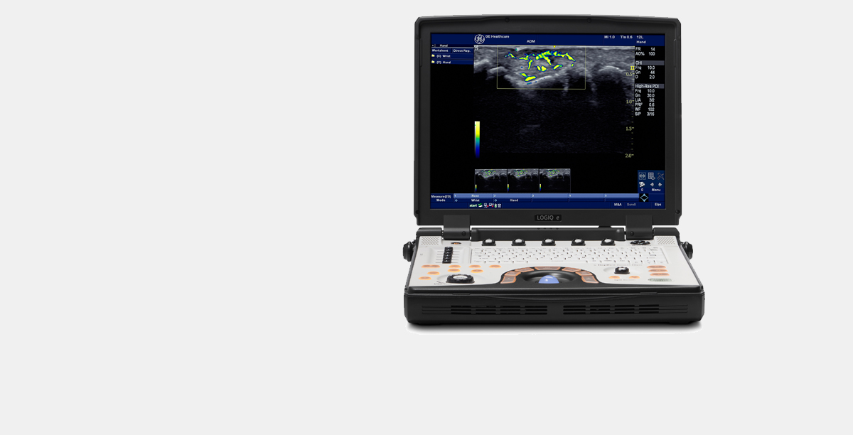 NextGen LOGIQ e Ultrasound