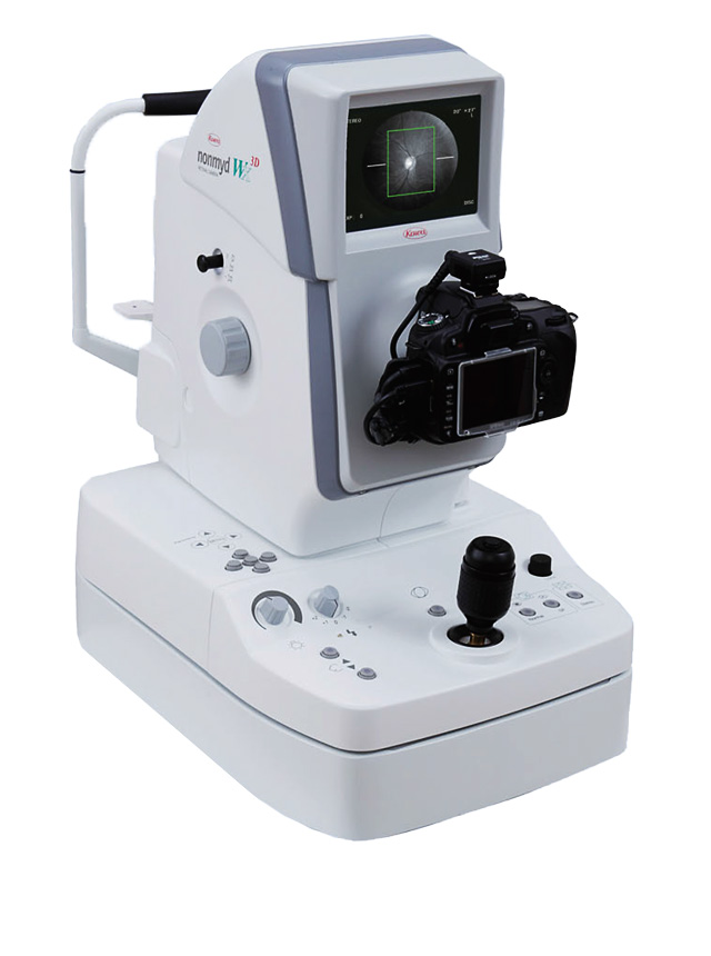 Nonmyd WX-3D Simultaneous Stereoscopic Retinal Camera