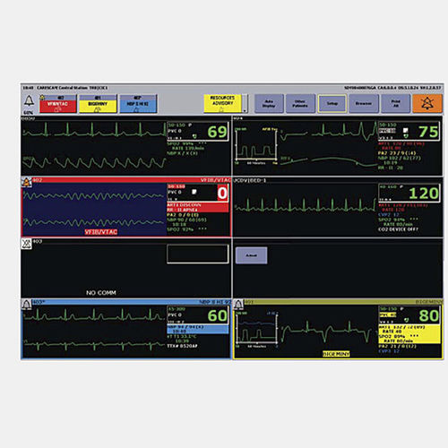 PATIENT MONITORING,CENTRAL PATIENT MONITORING STATION CARESCAPE