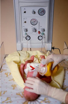 PNEUMATIC VENTILATOR / RESUSCITATION / INFANT