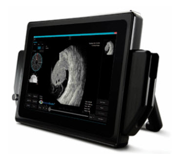 Sonomed Escalon VuPad Portable A/B-Scan Ultrasound