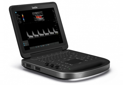 Sonosite Edge II