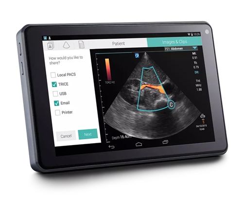 SonoSite iViz Ultrasound
