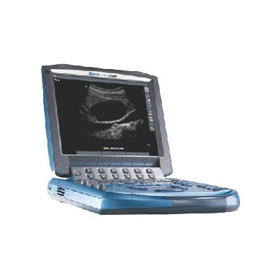 Sonosite Micromaxx Portable Ultrasound Machine