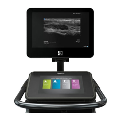 SonoSite X-Porte
