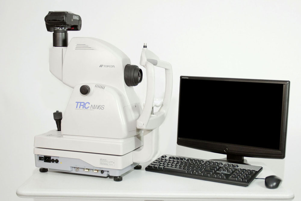Topcon TRC-NW6s Non-Mydriatic Fundus Camera (Pre-Owned)