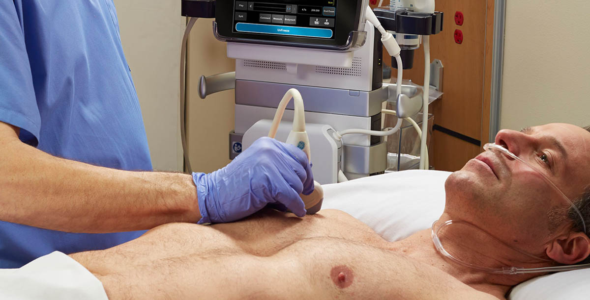 Venue 50 Ultrasound