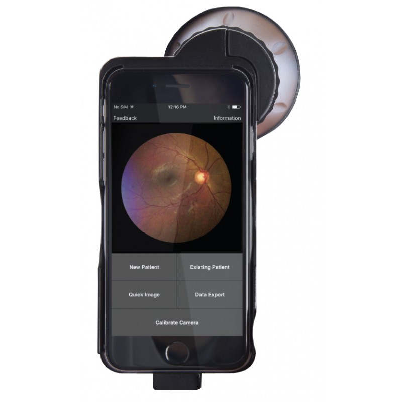 Volk iNview iPhone Fundus Camera