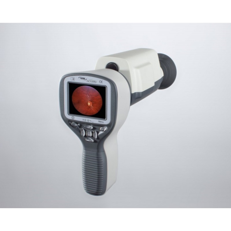 Volk Pictor Plus Portable Retinal Camera