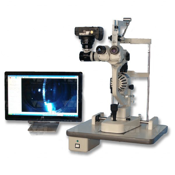 VSI Digital Slit Lamp Conversion