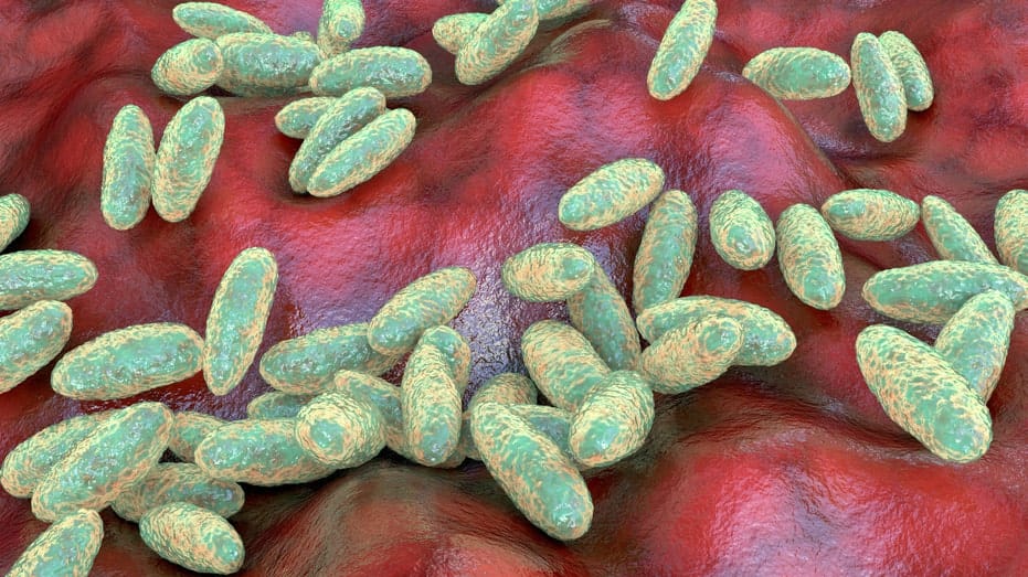 Russia Plague Lab Death