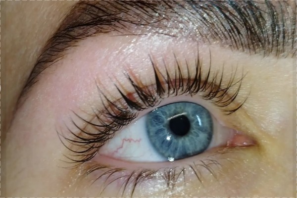 RIPSIEN KESTOTAIVUTUS