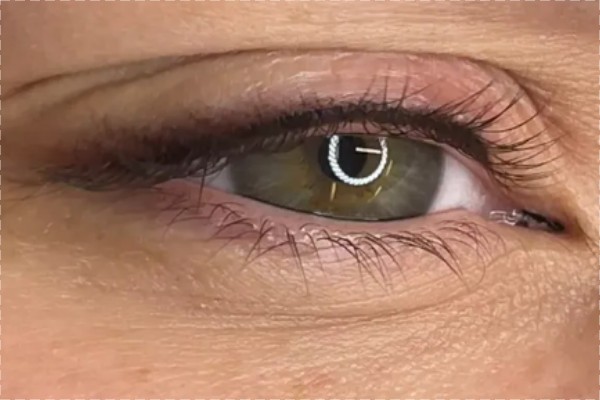 Kestopigmentointi: vahvistus silmän rajaus yli 3 kk 