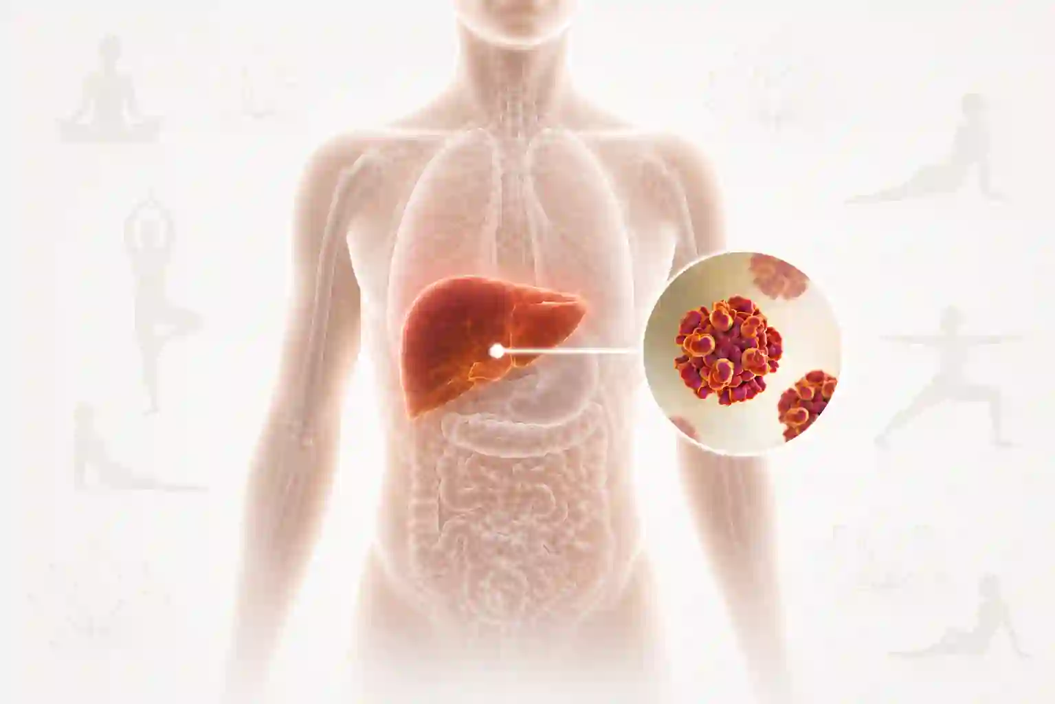 Yoga & Meditation for Hepatitis — A Tridosha Perspective