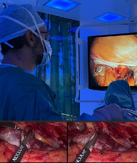Chirurgia colorettale in ginecologia oncologica: dalla radicalità alla qualità della vita