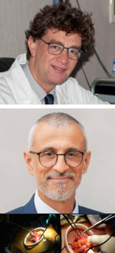 Chirurgia del colon: Resezione del sigma per via laparoscopica per malattia diverticolare complicata (Guerrieri) - Resezioni colo-rettali con tecnica laparoscopica hand-assisted - HALS (Morelli)
