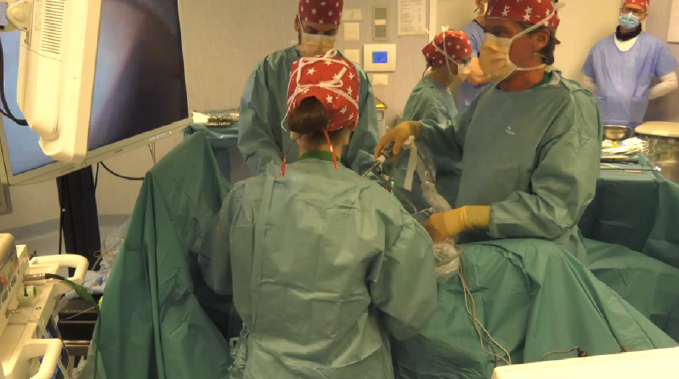 Il ruolo dell'Elettrochirurgia durante il trattamento chirurgico per patologie benigne e maligne del colon